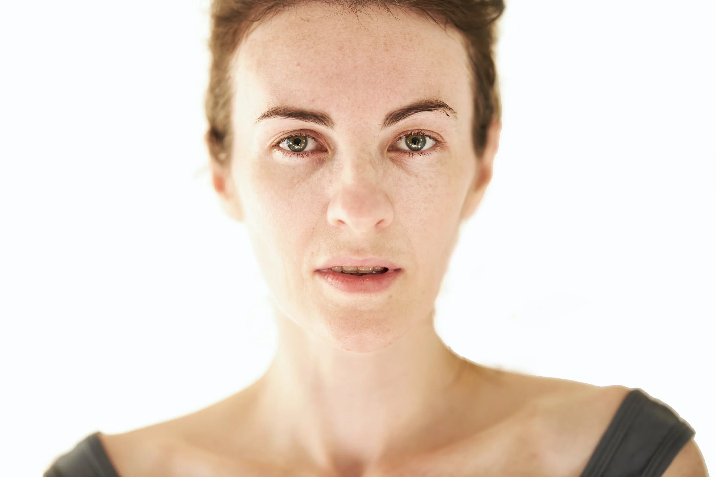 Cryolift face and neck treatment at Laser Loft